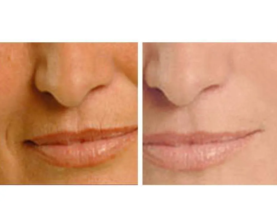 Age Perfect: Night Repair Cream   Vitamin C  Serum