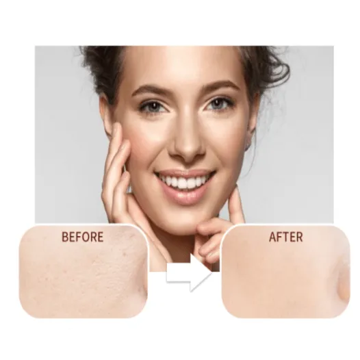 Matte My Day Face Primer - MQO 12 pcs