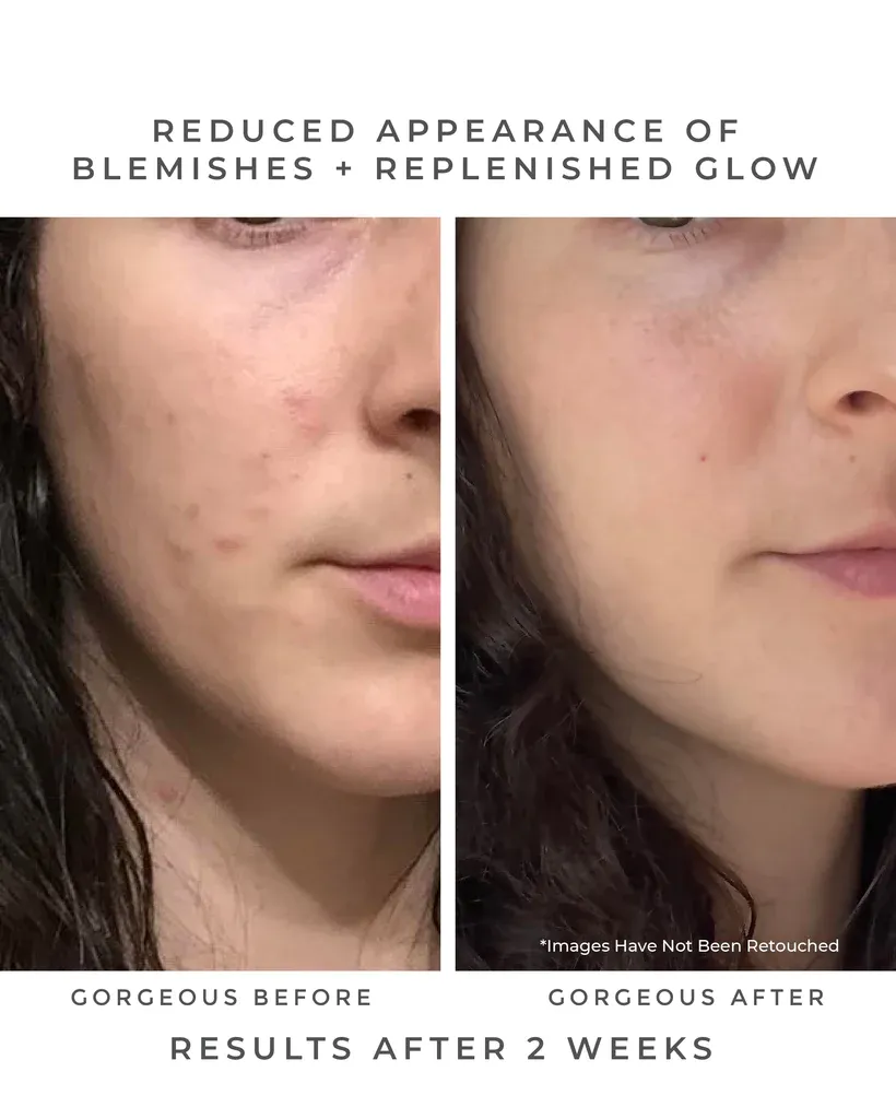 Oasis Deep Pore Gel Cleanser