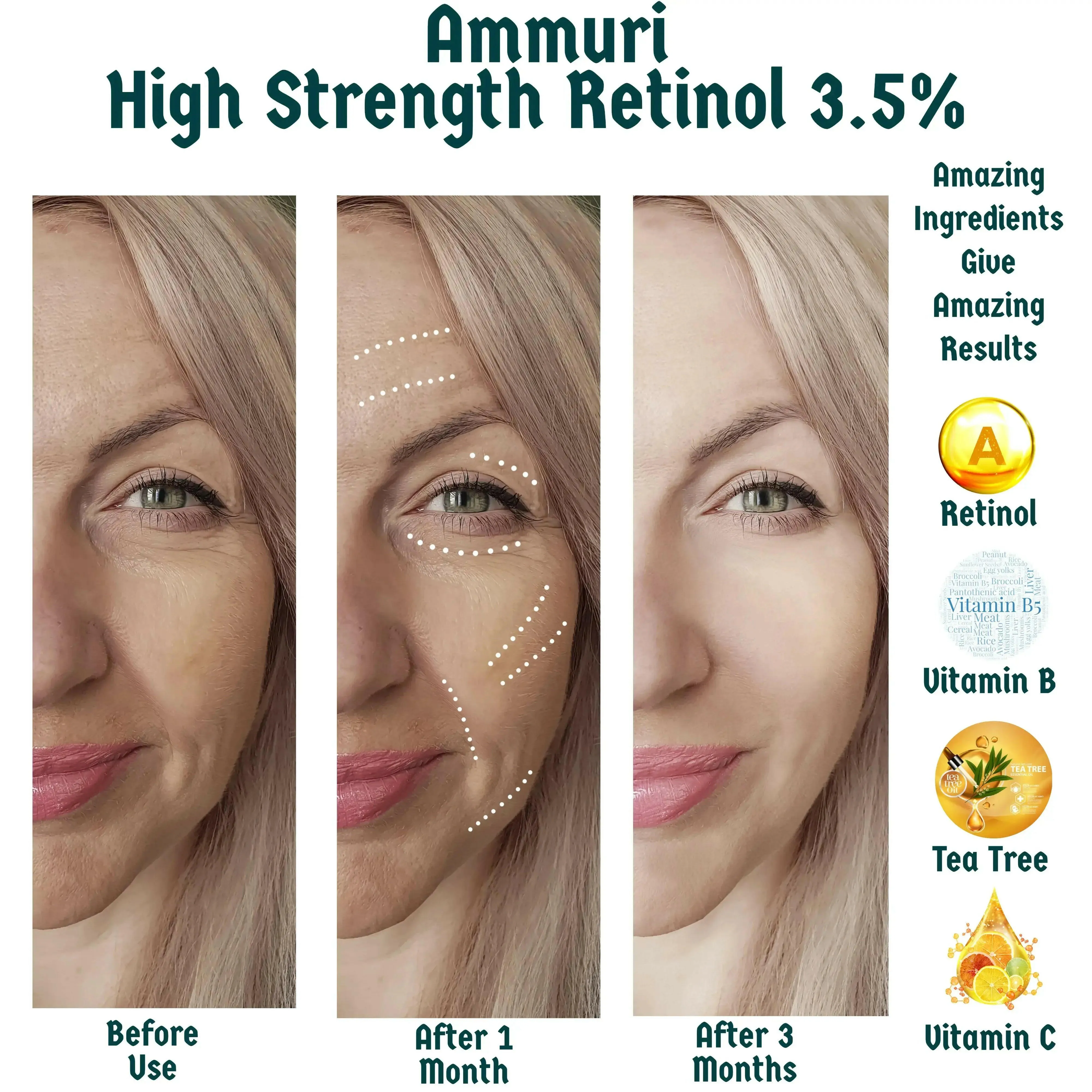 Retinol Face Serum 3.5% High Strength 30ml - with Hyaluronic acid, Vitamin C, E, B3, Aloe Vera